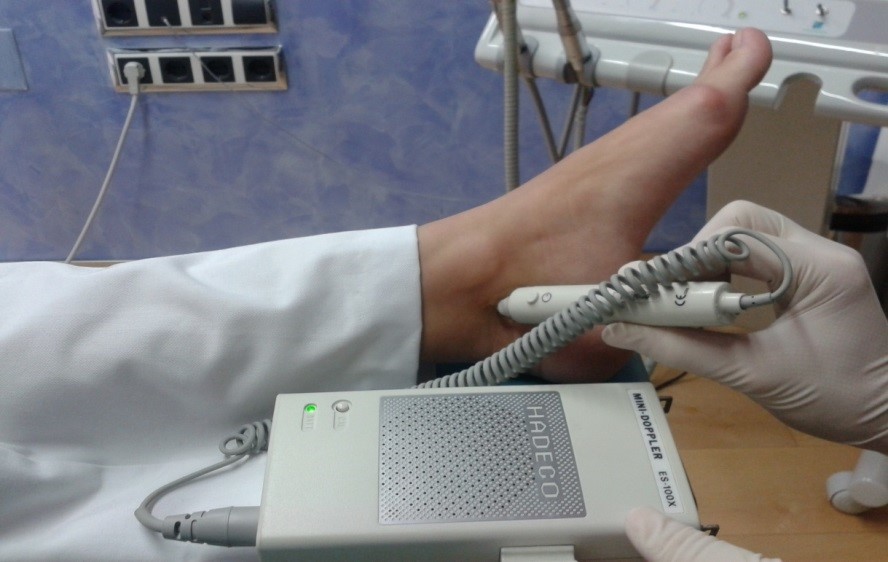 Tratamiento de pie diabético en Xátiva PodoXátiva